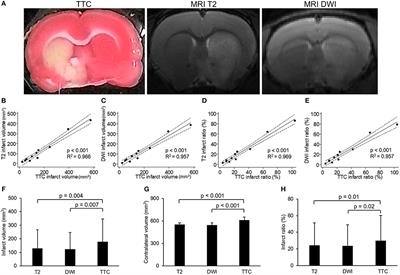 Neuroanatomy- and Pathology-Based Functional Examinations of Experimental Stroke in Rats: Development and Validation of a New Behavioral Scoring System